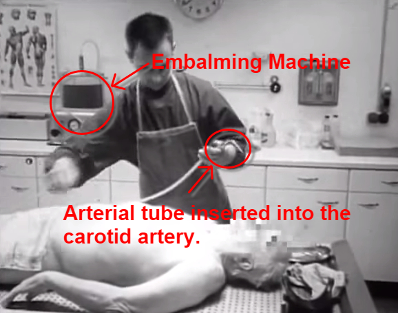CONFESSIONS OF A FUNERAL DIRECTOR » Eight Photos of the Embalming Process